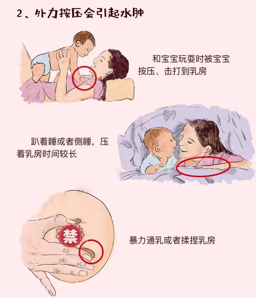 世界母乳喂养周|哺乳期乳房痛怎么办？——水肿篇